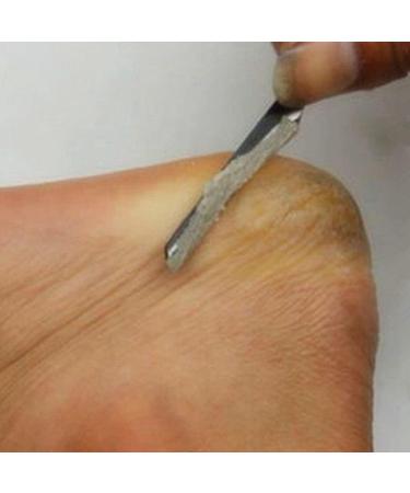 Foot Scraper Stainless Steel Foot Rasp Cutter Feet Dead Skin Callus Remover Pedicure Tool Pedicure Tool - Buy Online on GoSupps.com