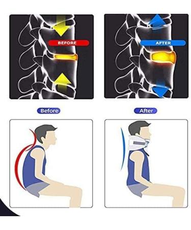 Buy Cervical Spine Traction Device - Travel Collar for Spinal Support & Posture Correction - Buy Online on GoSupps.com