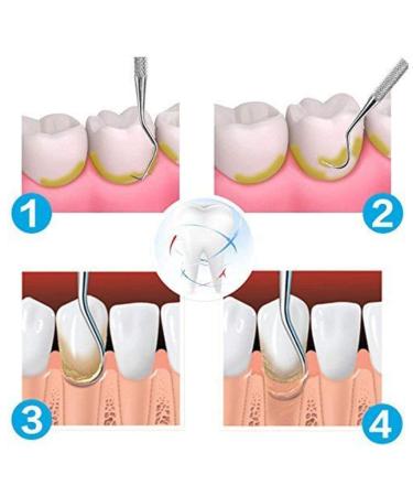 Dental Cleaning Tools Set - At Home Oral Care Kit with Stainless Steel Teeth Scraper Mirror Scaler & Pick - Best Dental Hygiene Tools for Plaque Removal - Buy Online on GoSupps.com