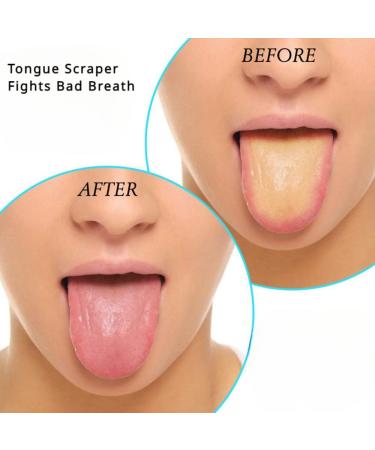 Buy Stainless Steel Tongue Scraper - Bad Breath Fighter & Oral Care Essential | Travel-Friendly Rose Gold Tongue Cleaner - Buy Online on GoSupps.com