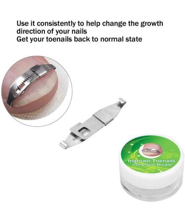 3pcs Stainless Steel Ingrown Toenail Corrector Set for Pain Relief and Paronychia Treatment - Buy Online on GoSupps.com