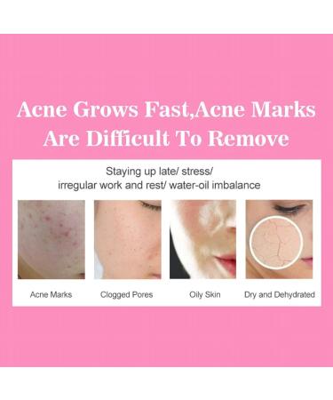 Kybbe Snail Cream Facial Cream Soft Moisturizing And Delicate Reduce Dark Anti Wrinkle Face Care Pore Essence Moisturizing Cream - Buy Online on GoSupps.com