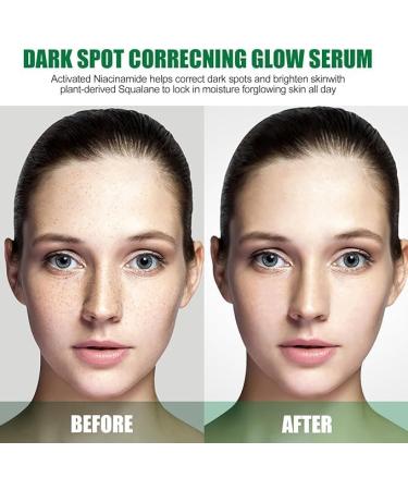 (Must - Have) 2 Jar Dark Spot Correcting Glow Serum Face Skin Serum for Dark Spot Treatment Hydration Moisturizing Lotion Improves Skin Skin - Buy Online on GoSupps.com