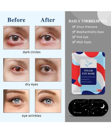 ONIYEA 15-Pack Unscented Steam Eye Masks for Dry Eyes Relief and Puffy Eyes - Disposable Moist Heating Compress Pads for Sleep - SPA Warm Eye Masks for Eye Fatigue - Buy Online on GoSupps.com