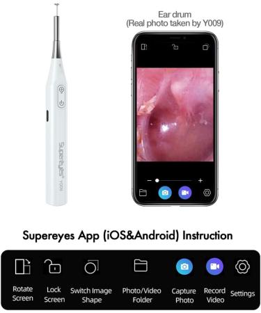 Premium Ear Wax Removal Otoscope & Curette - HD Camera with LED Lights for iPhone & Android | Ideal for Kids Adults & Pets - Buy Online on GoSupps.com