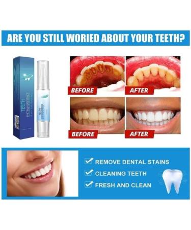 Dentiz Gums Therapy Gel & Tooth Whitening Pen - 2PCS | Effective Gum & Teeth Brightening Solution - International Shipping Available - Buy Online on GoSupps.com