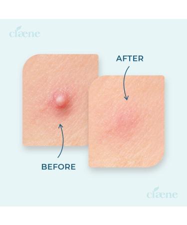 Organic Cotton Panty Liners & Acne Patches for Women - Cruelty-Free Daily Liners & Skin Treatment Stickers - Vegan & Absorbent - Buy Online on GoSupps.com