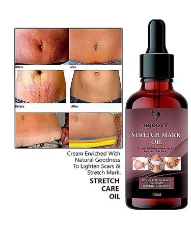 Stretch Mark Skin Oil - Reduce Scars Boost Elasticity | 40 ML - Best International Shipping - Buy Online on GoSupps.com