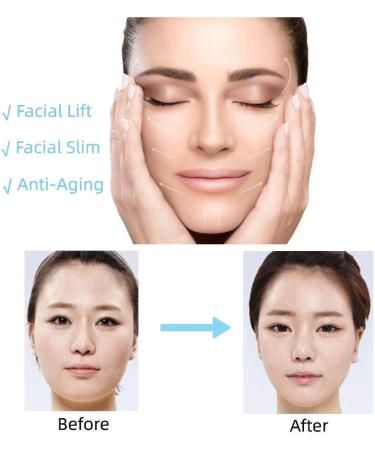 Anggrek V-Line Face Lifting Mask - Slimming Strap for Jawline Definition & Beauty | International Shipping Available - Buy Online on GoSupps.com