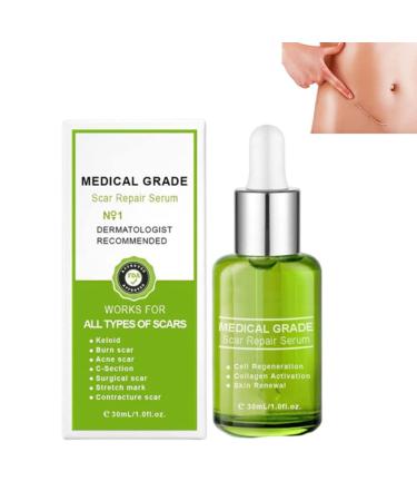 flysmus Advanced Scar Repair Serum Scar Removal Medical Grade Spray for All Types of Scars (1PCS)