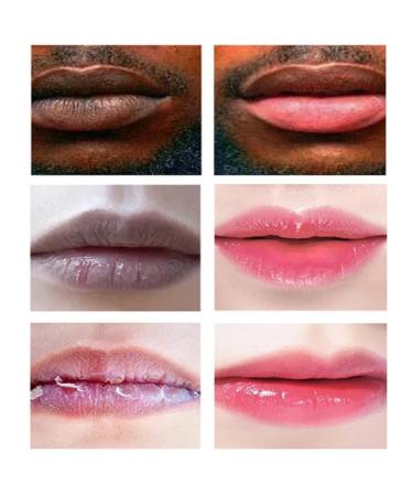 2PCS Lip Lightening Balm Dark Black Removal Exfoliation Pigmentation Fade Dull Pink Balm Anti-Crack Moisturizing Nourishing Lip Care Smokers and Non-Smokers (Pink) - Buy Online on GoSupps.com