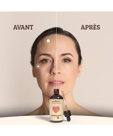 GoNaturals Rosehip Oil - 50ml - 100% Pure and Cold Pressed - Vegan and Cruelty Free - Unscented - Rosehip Oil: Anti Aging Skin Hair Scars and Stretch Marks - Buy Online on GoSupps.com