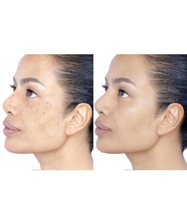 Buy Triple C & E Complex Fluid - Boost Your Skin's Radiance | International Shipping Available - Buy Online on GoSupps.com