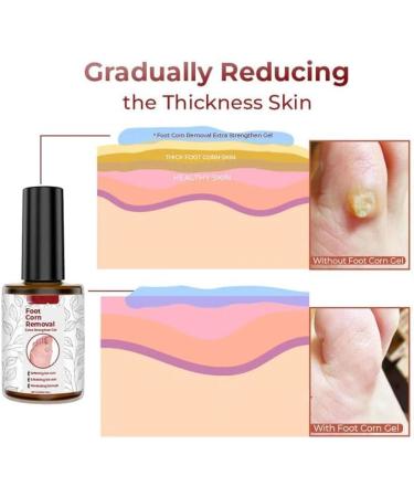 Extra Strength Foot Corn Removal Gel - 10ml Liquid (3pcs) | GFOUK - Buy Online on GoSupps.com