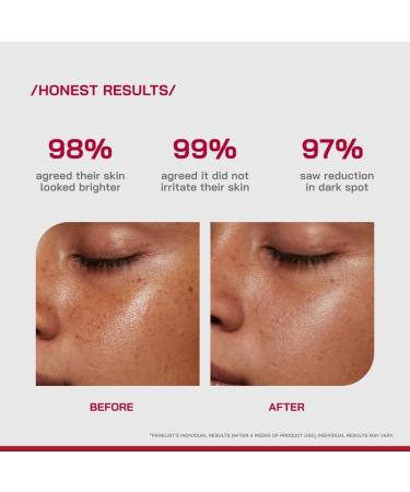 /PHD/ 10% Vitamin C Brightening Serum | For Glowing skin Oily skin Dry skin | Dark Spots & Uneven Tone Treatment | Face serum for Women & Men | Formulated with Global Dermatologists | 60ml - Buy Online on GoSupps.com