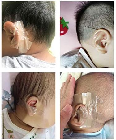 Baby Soft Silicone Ear Correctors Tape - Auricle Valgus Correction Patch for Child Infant | Ear Care Tools - Buy Online on GoSupps.com