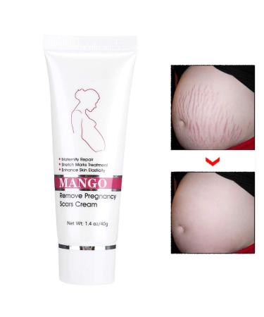 Stretch Mark Cream - Effective Pregnancy & Scar Treatment | Elimina Estr as - Buy Online on GoSupps.com