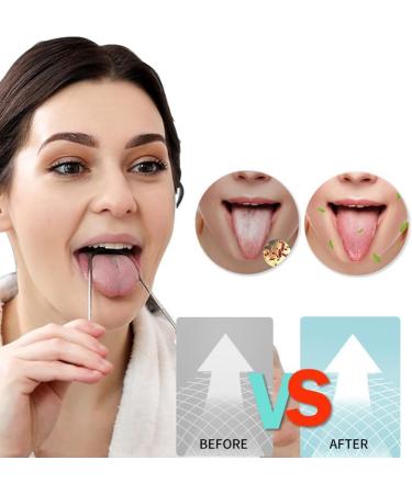 Ikappy Professional Stainless Steel Tongue Scraper - Enhance Oral Care Combat Bad Breath & Achieve Fresh Breath - Buy Online on GoSupps.com