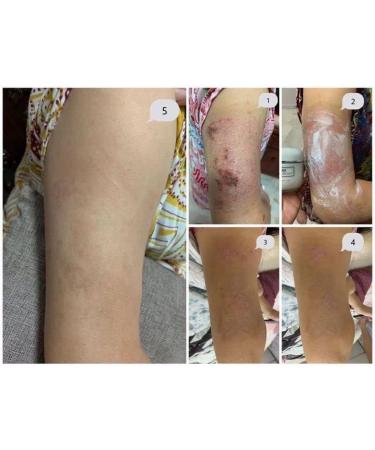 CNI NUTRIMOIST - 120 g - Buy Online on GoSupps.com