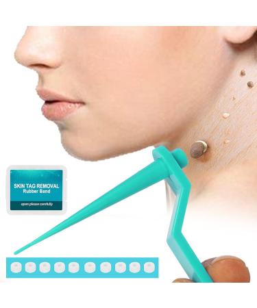 77PCS Skin Tag Remover Patches for 2-5mm Skin Tags - Green Skin Tag Removal Kit - Buy Online on GoSupps.com