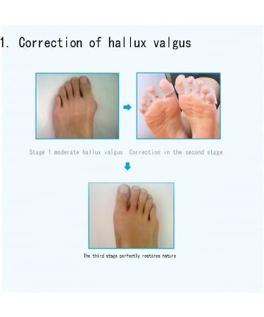 Buy Cazaru Gel-Teshrenner & Gel-Zendehner for Overlapping Toes | Comfortable Relief for Yoga & Sports - Fast Shipping Worldwide - Buy Online on GoSupps.com