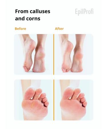 Vosk Crack Wax Professional Deep Moisturizer Cream for Dry Skin with Beeswax - 100ml | Hydrating Relief for Smooth Skin | International Shipping - Buy Online on GoSupps.com