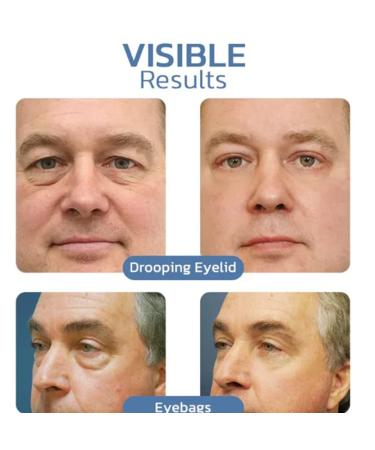 Filoyer OPENEYES Awaken Peptide Lifting Eye Gel | HIMSE Men's Depuffing Eye Gel | Anti-Aging Cream for Puffiness & Dark Circles - Buy Online on GoSupps.com