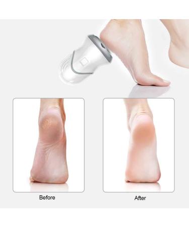 Dioche Electric Foot Grinder - Two Gears Speed USB Charging Exfoliating Callus Dead Skin Remove Electric Foot File - Safe Foot Protection Long-lasting Battery Life USB Charging Adjustable Speed - Buy Online on GoSupps.com
