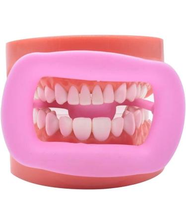 Vepoty Dental Retractor Set - 2 Soft Silicone Intraoral Lip & Cheek Retractors (Pink & Sky Blue) | Reusable Dental Orthodontic Mouth Opener - Buy Online on GoSupps.com