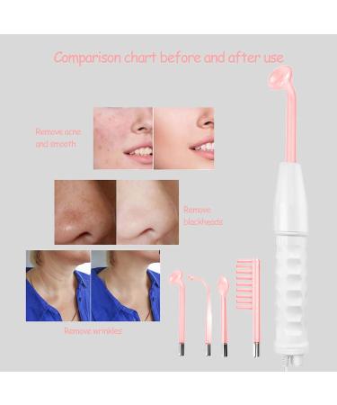 High Frequency Skin Tightening Devices | Hf Rod for Acne Treatment & Anti-Aging | 4 Neon Facial Massage Tools - Buy Online on GoSupps.com