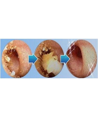 Ear Wax Remover 13 * 7 * 3 Electric Ear Cleaner Easy Earwax Removal Soft Spiral Cleaner Painless Safety Earwax Removal Tool (Assorted Color) - Buy Online on GoSupps.com