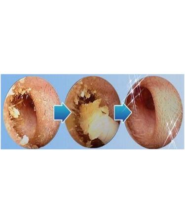 Ear Wax Remover Azusumi 13 * 7 * 3 Electric Ear Cleaner Easy Earwax Removal Soft Spiral Cleaner Painless Safety Earwax Removal Tool