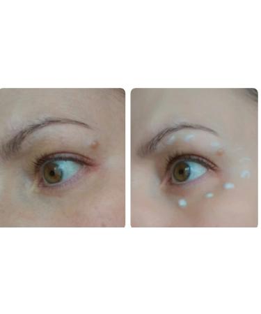 Bielita & Vitex MEZOcomplex Eye Cream 40+ Intensive Moisturizing 30ml with Hyaluronic Acid - For All Skin Types - Buy Online on GoSupps.com