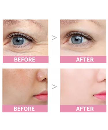 VGO Hydrating Eye Stick Balm - Anti-Wrinkle Moisturizer for Saggy Skin - Under Eye Treatment to Smooth Skin Texture - 0.19 oz - International Shipping Available - Buy Online on GoSupps.com