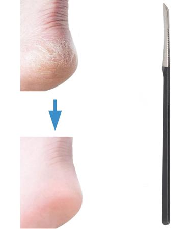 Entatial Calluses Scraping Knife Dead Skin Removal Pedicure Knife Ergonomic Stainless Steel for Pedicure Scraping Dead Skin Relieve Itchn EntatialBIAJS2M - Buy Online on GoSupps.com
