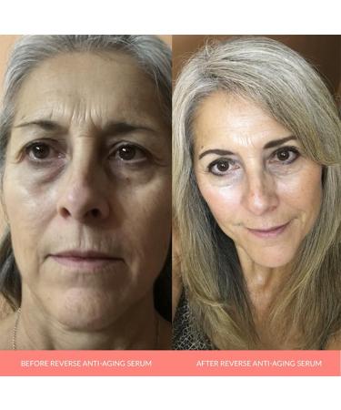 AnnieMak Reverse Anti Aging Serum for Face - Deep Moisturizer for Women to Reduce Wrinkles Dark Spots & Facial Lines - Hydrating Collagen Boost (1 fl oz - Buy Online on GoSupps.com