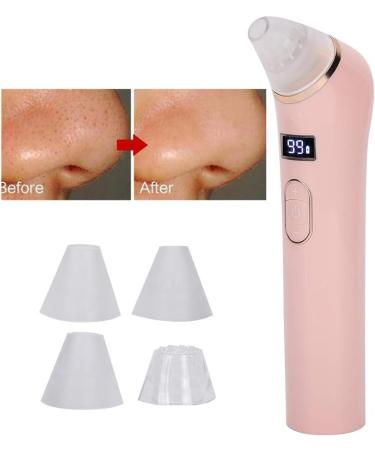 Blackhead Remover Pore Vacuum 4 Suction Heads Blackhead Remover Ergonomic Design and Convenience Premium Materials(pink) - Buy Online on GoSupps.com