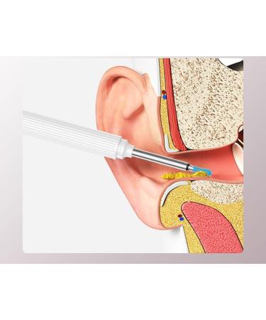 Buy Ear Wax Removal Tool - Wireless Ear Cleaner with Camera & Light for iOS & Android - Effective Earwax Removal Kit (Black - Buy Online on GoSupps.com