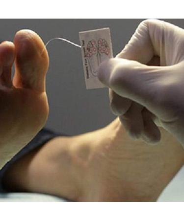 Semmes Weinstein 5.07 Monofilament Wire 10g Neuropathy Diabetic Testing Kit - 20 Disposable Filaments - Buy Online on GoSupps.com