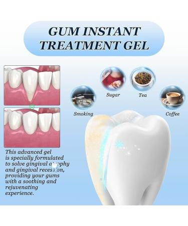 Lovilds Gums Therapy Gel - Effective Gum Care & Relief | Lovilds Gel Experience - Buy Online on GoSupps.com