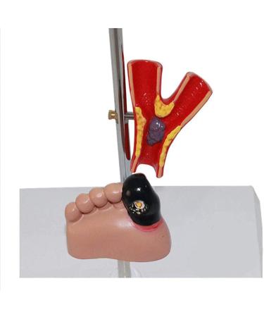 Dytah Pathological Diabetes Model - 5-Part Educational Kit for Eye Heart Kidney Artery & Foot Training | International Shipping Available - Buy Online on GoSupps.com