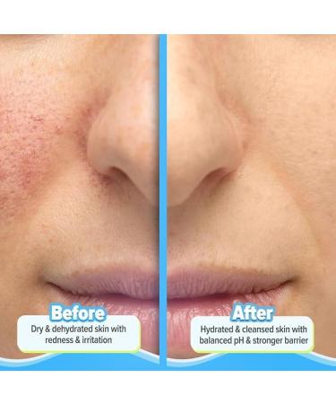 Face Cleanser with Avocado & 5 Essential Ceramides - 100ml | Non-Oil Stripping Formula for Dry & Sensitive Skin | Strengthens Skin Barrier | Suitable for Men & Women | Shop Internationally - Buy Online on GoSupps.com