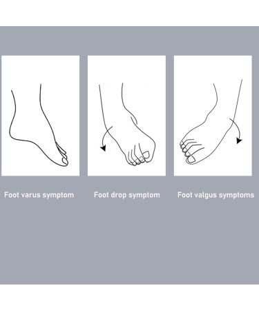 Pomya Foot Varus Corrector Belt | Foot Drop Brace for Stroke Patients | 24-Hour Support for Left & Right Foot Varus/Valgus - Buy Online on GoSupps.com