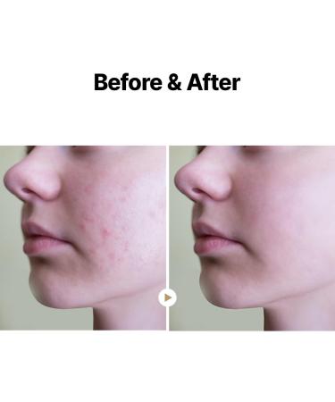 MAY COOP Raw Moisturizer Face Cream + Raw Moisture Korean Toner Pads 160ml (70 Pads) Bundle - Buy Online on GoSupps.com