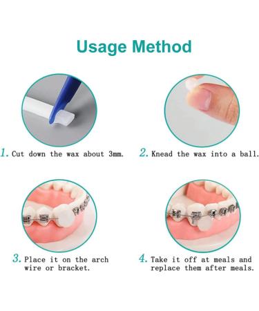 Elastic Teeth Rubber Bands (300 Pieces) & Orthodontic Wax (3 Pieces) for Braces Relief - Streak Dental Wax for Pain & Irritation - Buy Online on GoSupps.com