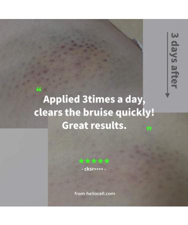 Doctor Petit Cream Bundle for Bruises, Eye bags, Sunburn, Dark Spots - 2 Pack 1 Oz Pocket Size - Buy Online on GoSupps.com