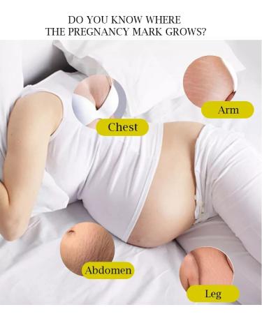 Body Butter | Stretch Marks & Scars by Mother To Mother - Buy Online on GoSupps.com