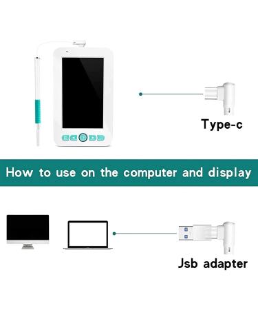 Jteremy Digital Otoscope 4.3 Screen, 6 LED Lights, 5.5mm Camera, IP67 Waterproof - Ear Wax Removal Tool - Buy Online on GoSupps.com