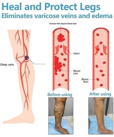 Spayeim Blueshot Turmalin-Ion Magnet Fiber Ice Socks | Body Forming Beige Stretch Socks - Ship Worldwide - Buy Online on GoSupps.com