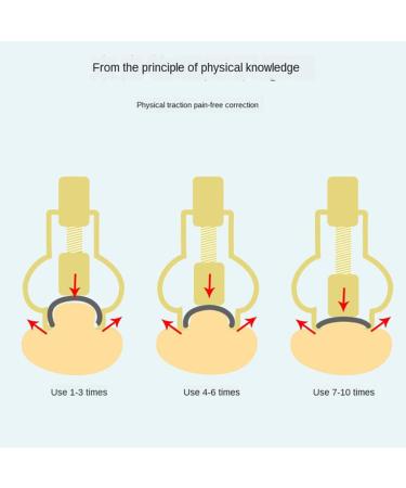 Nail Correction Toe Nail Correction Tool Ingrown Toenail Treatment Tool Painless Inflammation Cure Metal Pedicure Manicure/138 - Buy Online on GoSupps.com
